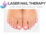 Laser Nail Therapy- Largest Toenail Fungus Treatment Center Photo
