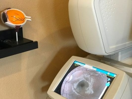 HindSight Eyecare 1 Hour Optical & Eye Exams The Villages, FL - 01.10.18