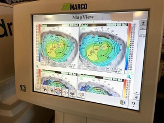 HindSight Eyecare 1 Hour Optical & Eye Exams The Villages, FL - 01.10.18